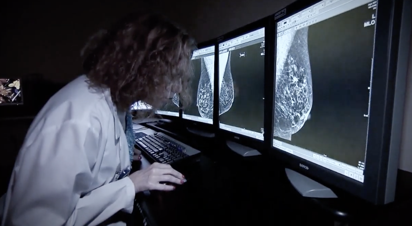 koss_national-triple-negative-breast-cancer.png